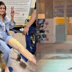 Shilpa Shetty breaks her leg on set of Rohit Shetty’s ‘Indian Police Force’ movie