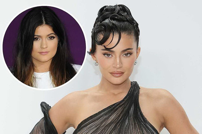 Kylie Jenner sets record straight on plastic surgery