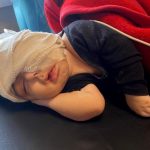 Al-Shifa team successfully conducts rare eye surgery of an Afghan infant